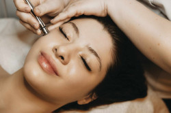 Microneedling à Nantes centre